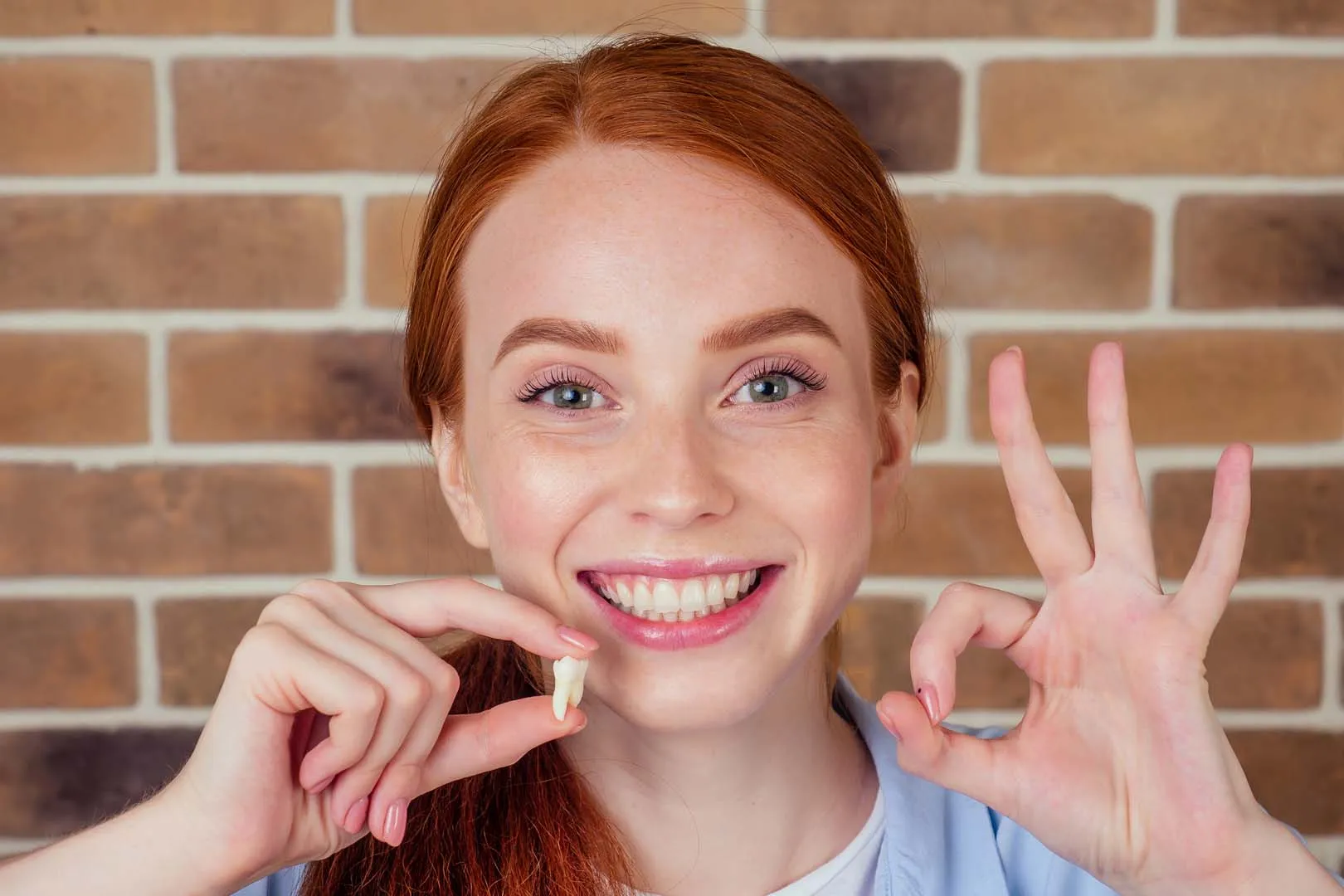 Wisdom teeth removal at Gentle Dental